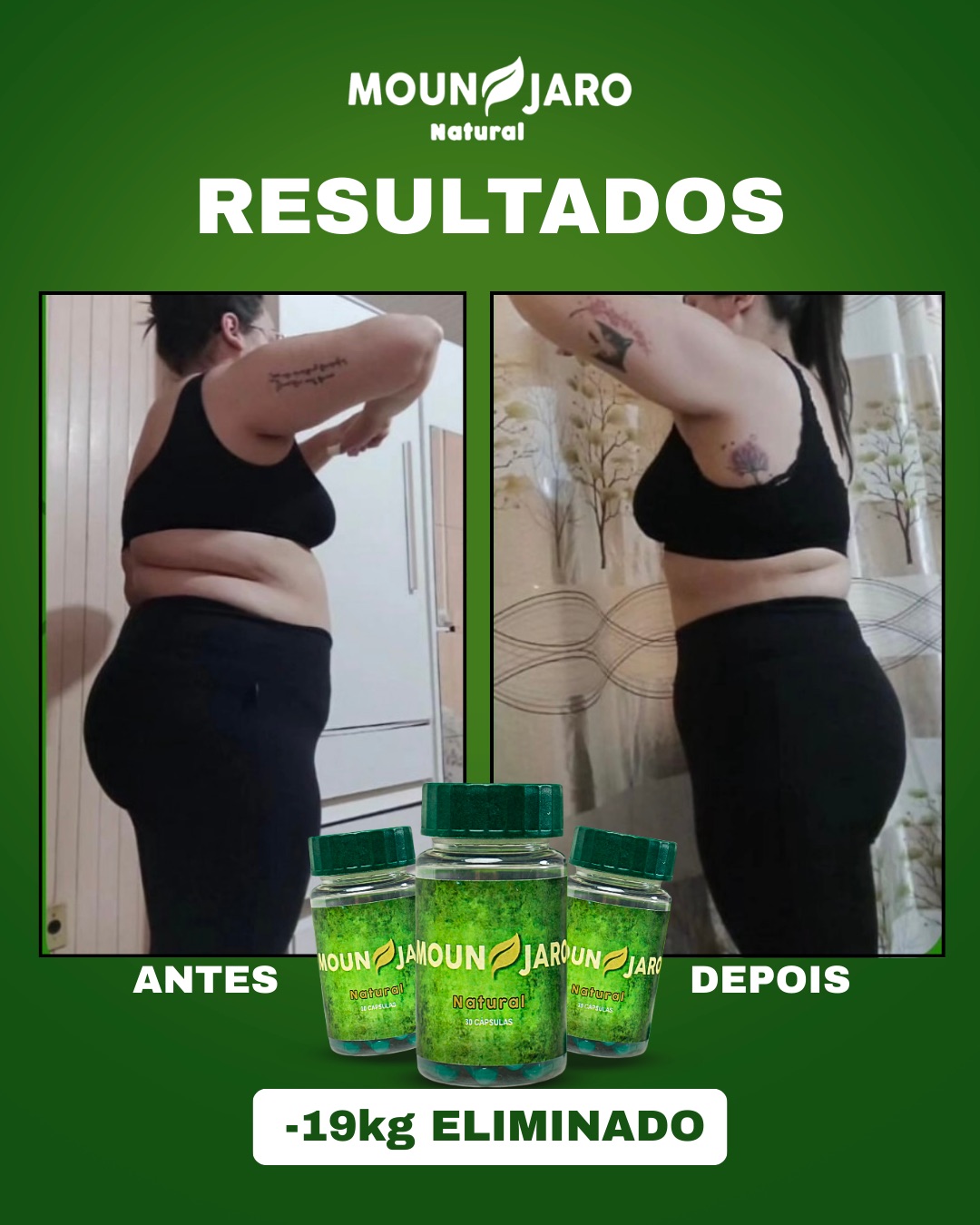 ANTES E DEPOIS - MOUNJARO - CRIATIVO - FEED